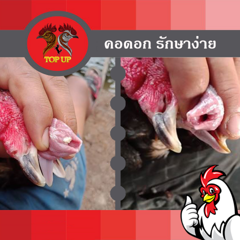 รักษาคอดอก X2